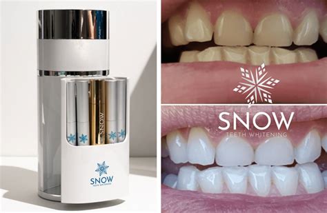 Get Snow-White Teeth with the Magic of Snow Magic Powder